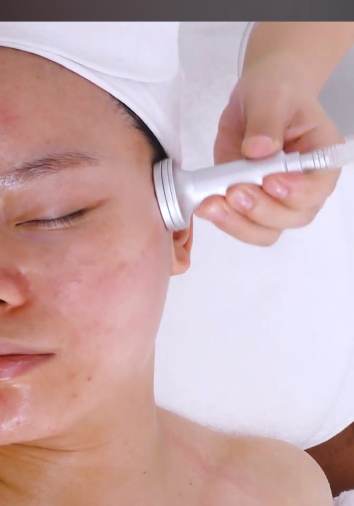 Lymphatic Drainage Cupping Facial