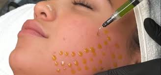 BioRePeel + Microneedling