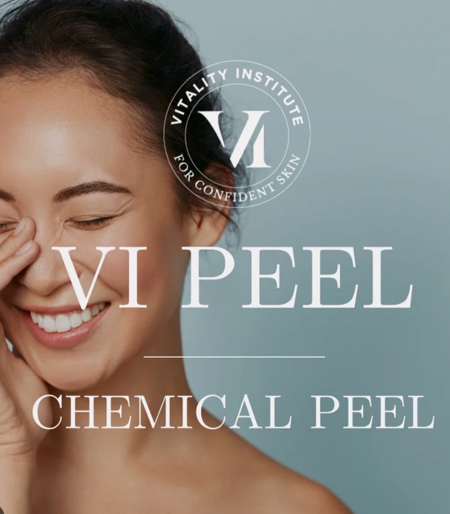 Vi Chemical peel