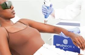Laser Hair Removal