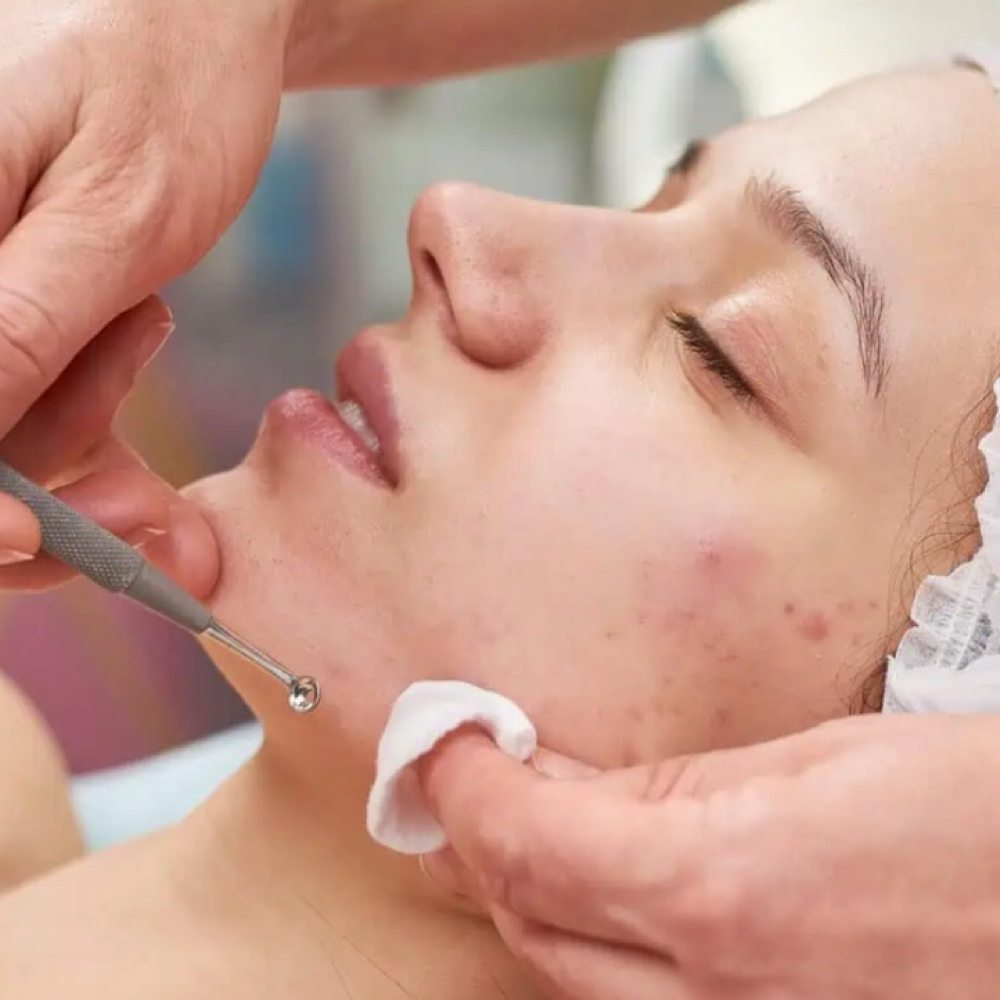 Luxe Acne Clearing Facial at Luxe Skin & Lash Studio in Tewksbury, MA