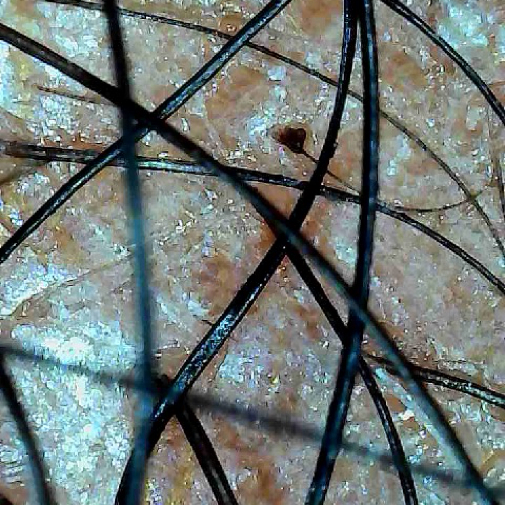 Scalp Analysis at O T Beauty Studio in Columbia, MD