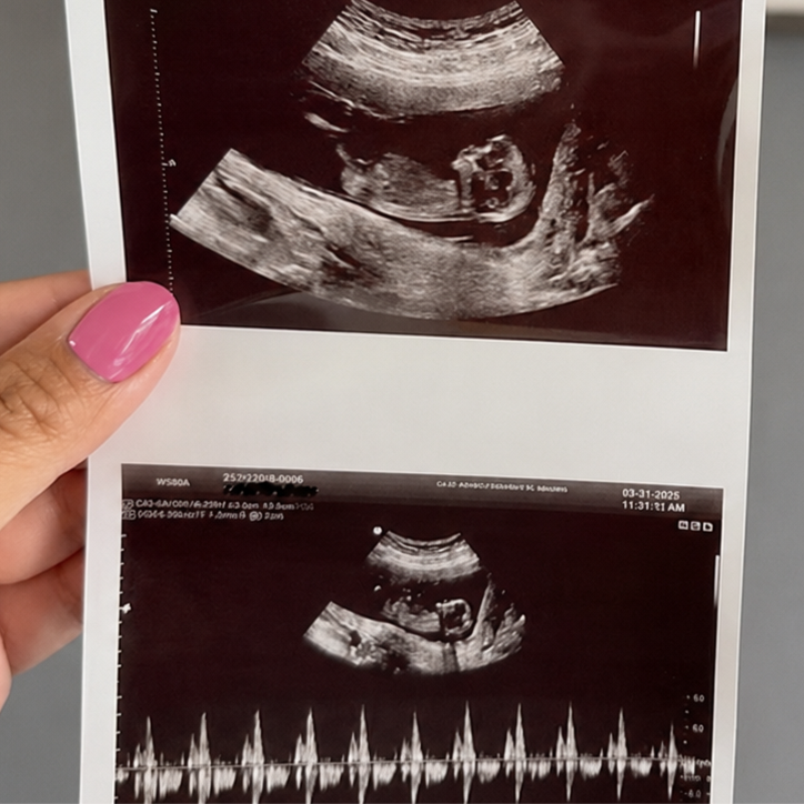 Weekday Baby Peek at Rancho Cucamonga 3D 4D Ultrasound by 4D Special Delivery in Rancho Cucamonga, CA