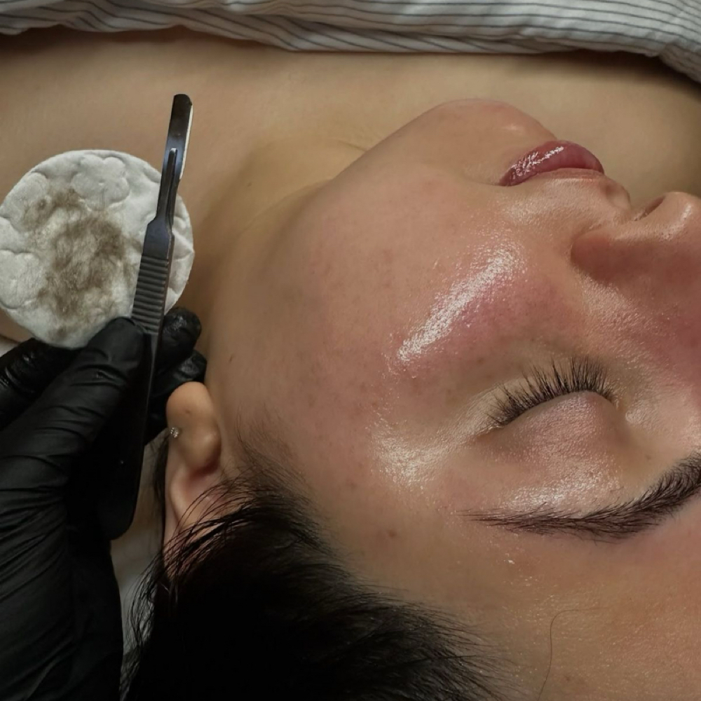 The Dermaplane Facial at Halo + Honey Skin Studio in Corpus Christi, TX