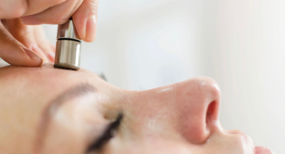Microdermabrasion