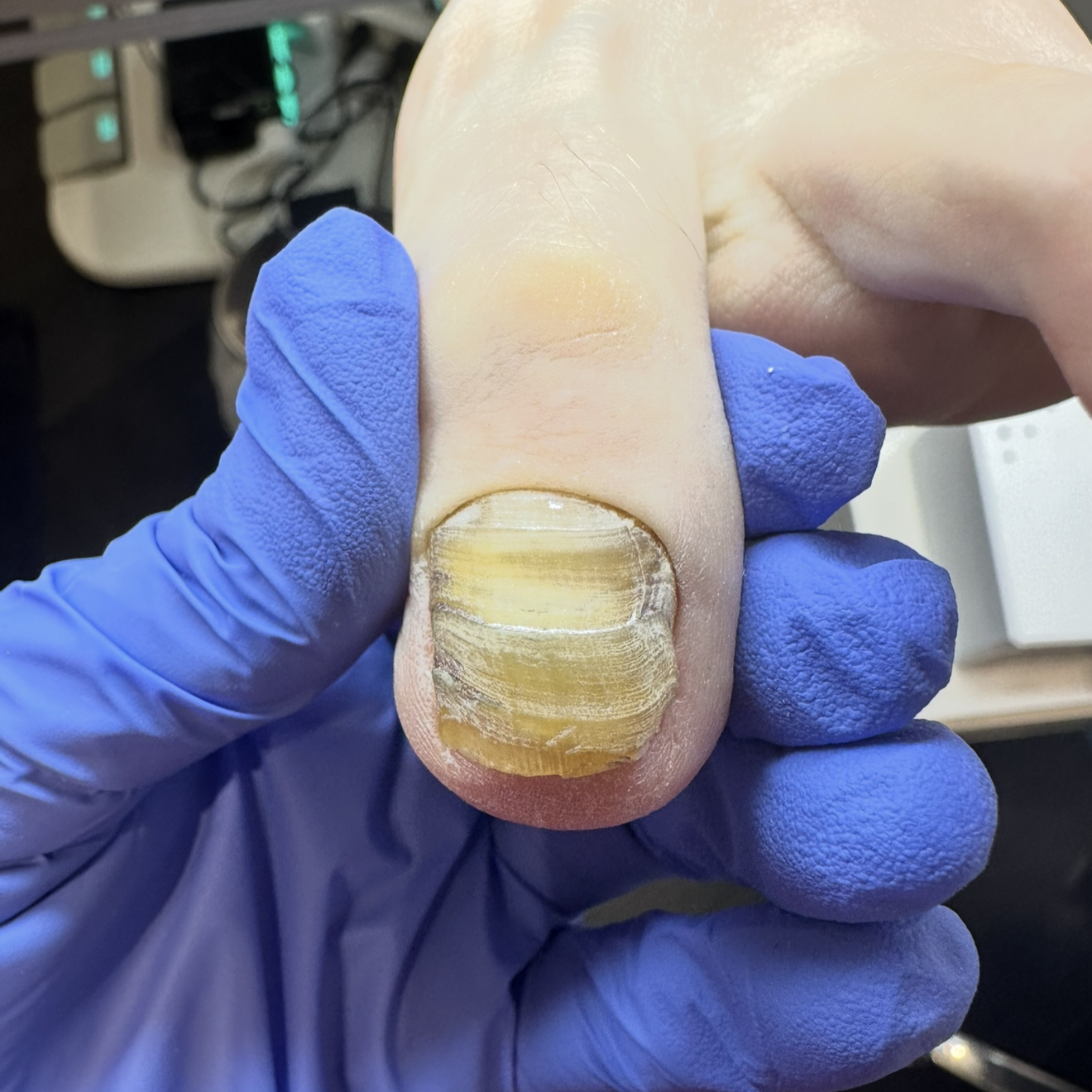 Aesthetic Toenail Service