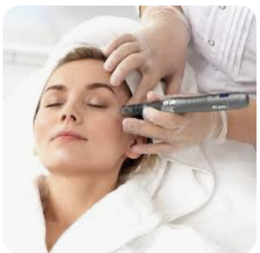 Microneedling at PNW BEAUTY in Roseburg, OR