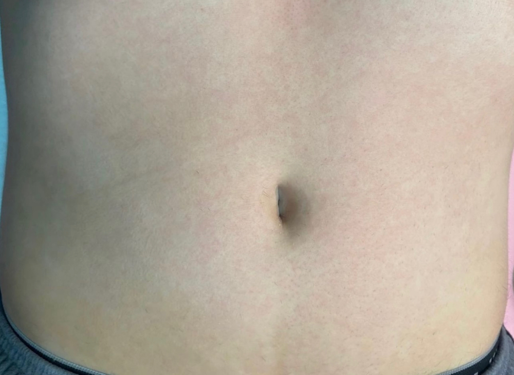 Full Stomach