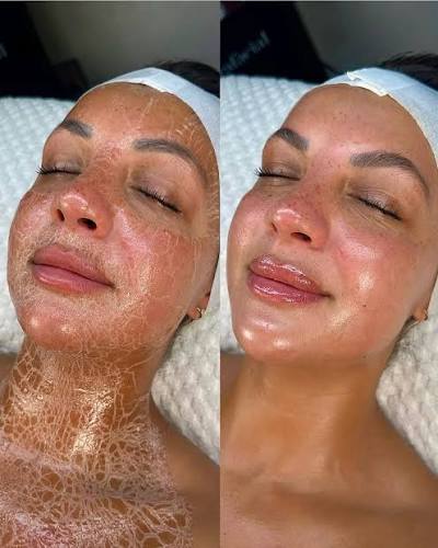 Firming Peptide Facial
