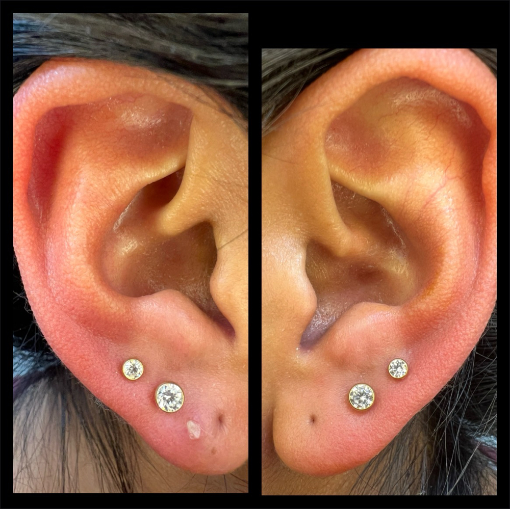 Two Pairs Of Earlobe Piercings