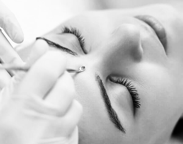 Extractions (Add On)