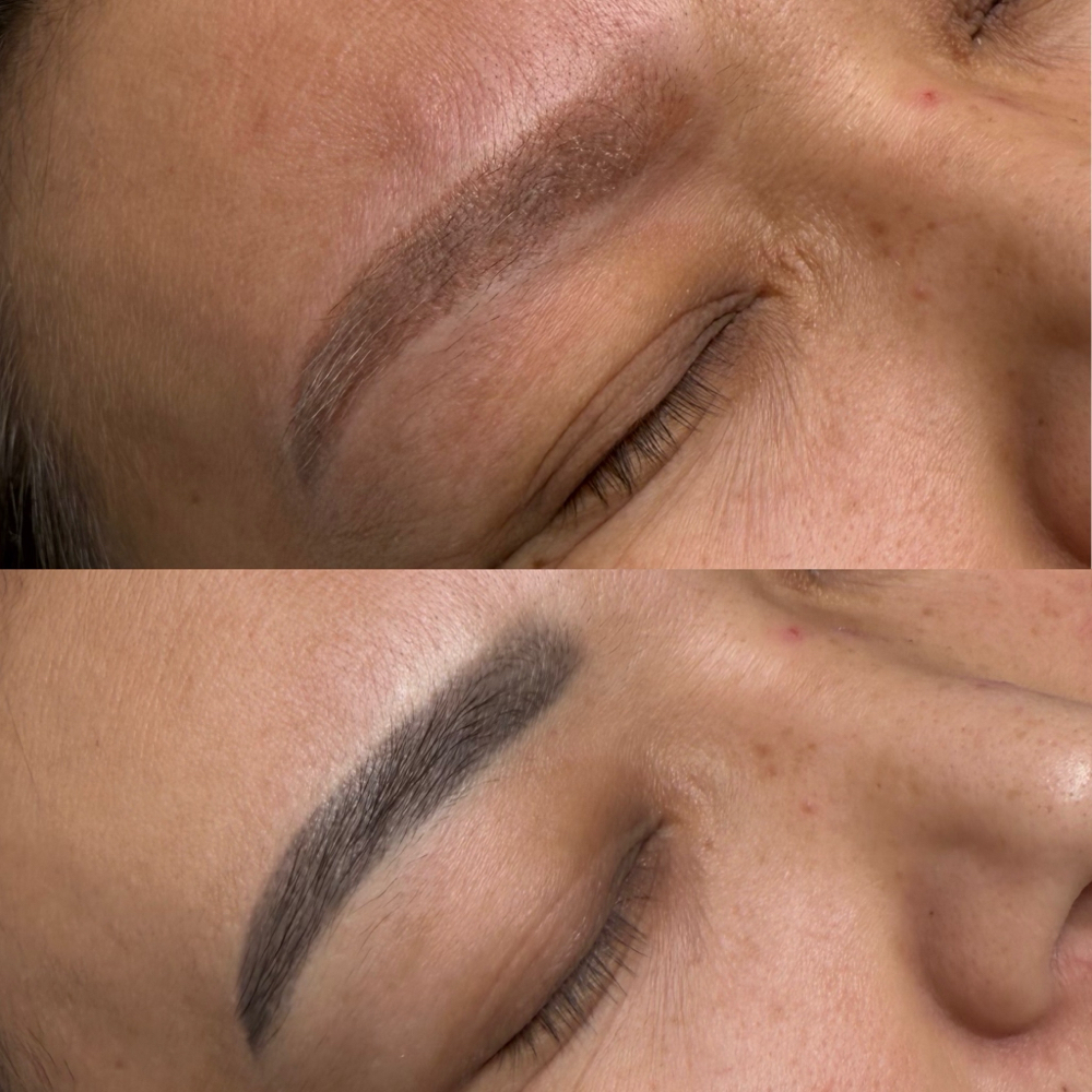 Laser Removal at Alina PMUartist in Lincolnshire, IL