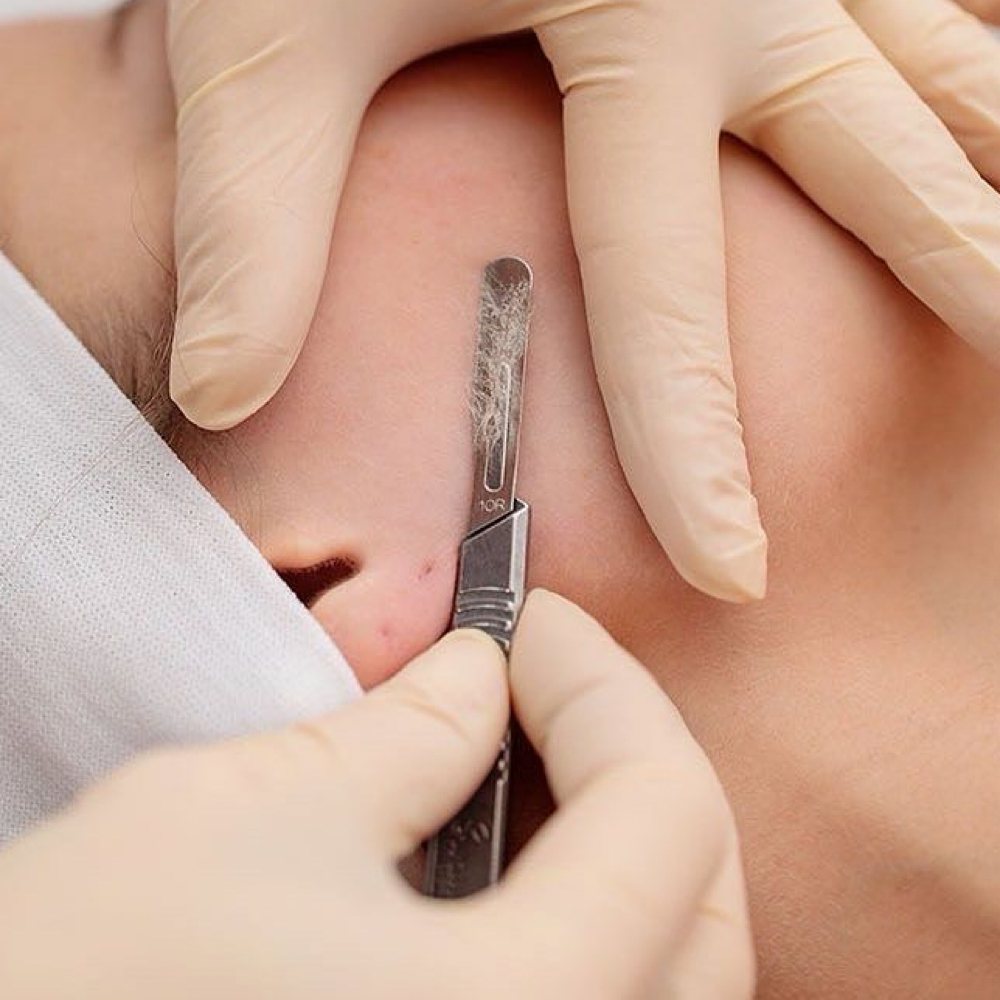 Dermaplane Add On at Magnolia Artistry in Draper, UT