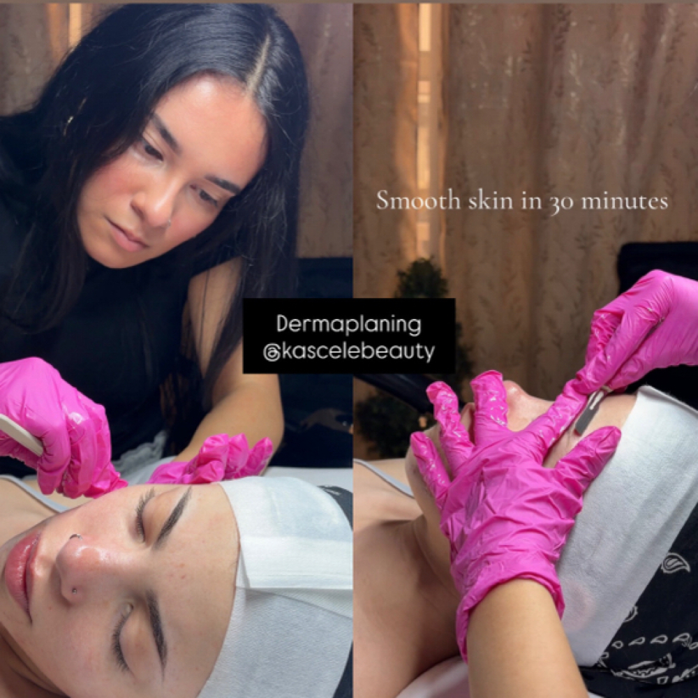 Dermaplaning Facial at Kassandra Camacho in Port Jefferson, NY
