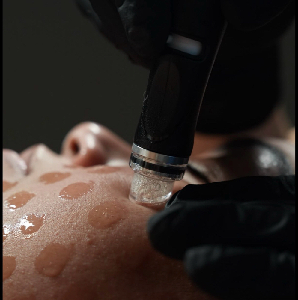 HydraFacial at Zani Skin Studio in Andover, MA