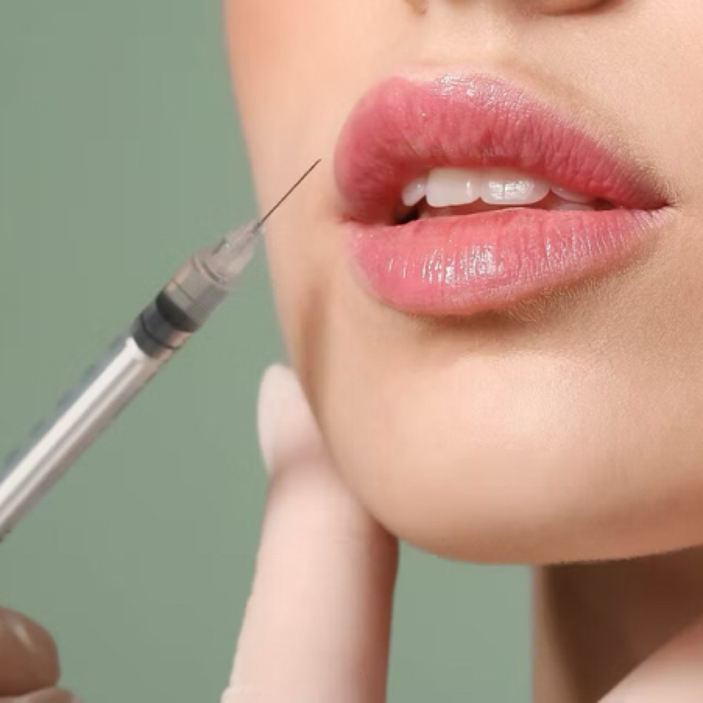 FULL LIP PLUMP at Jay Michelle Aesthetics & Wellness in Lake Jackson, TX