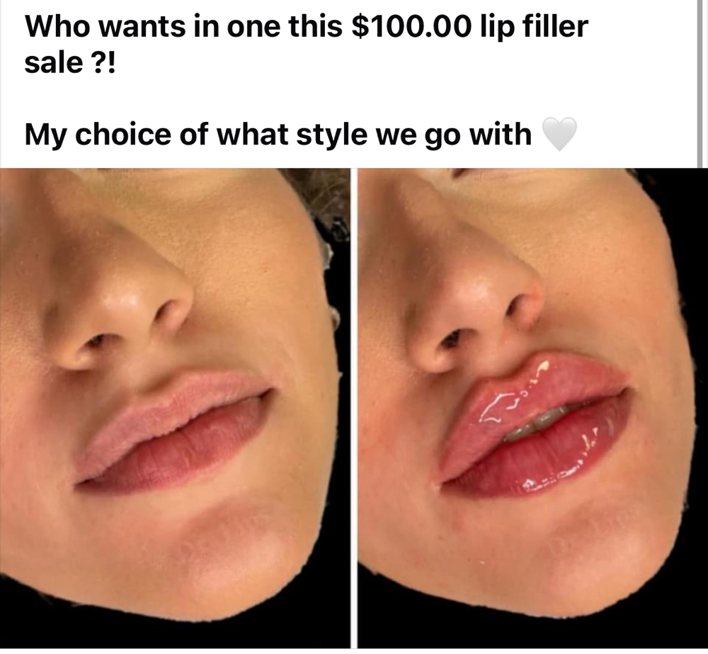 My Choice Deal