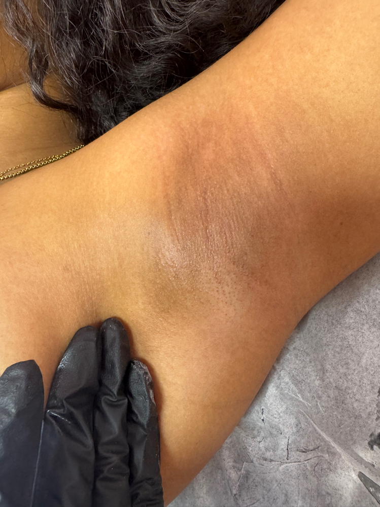 Underarm