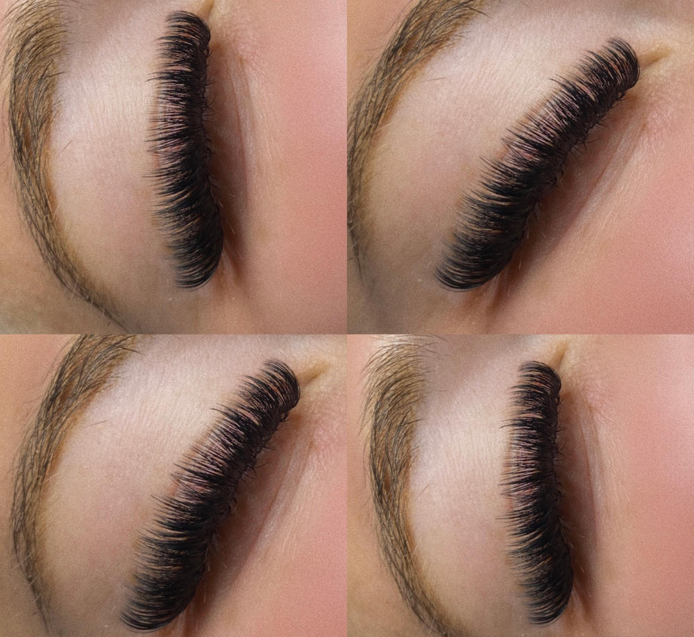 Mini Fill (5-9 Days)