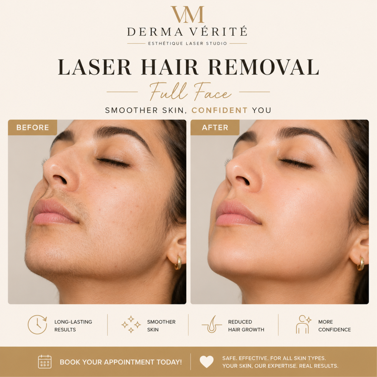 Laser Hair Removal- Full face at Derma Verite Esthetique Laser Studio in Elmhurst, NY