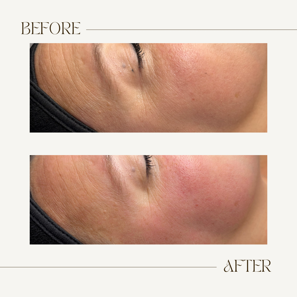 Revitalize Facial