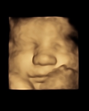 3D/4D Session (16-36wks)