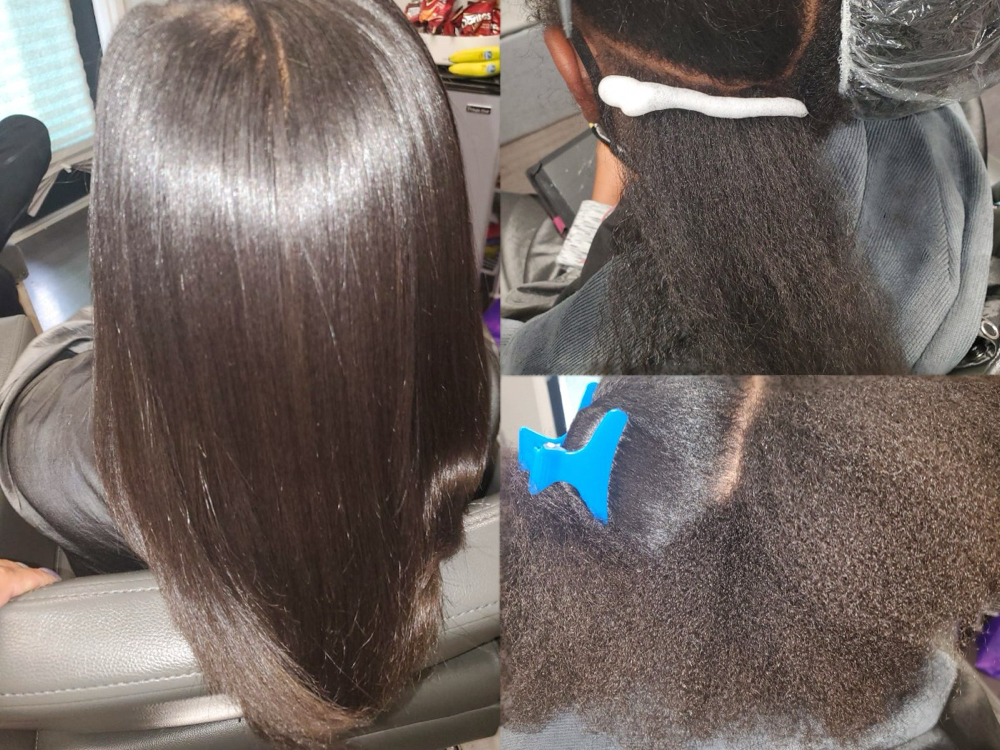 Amino Acid Treatment