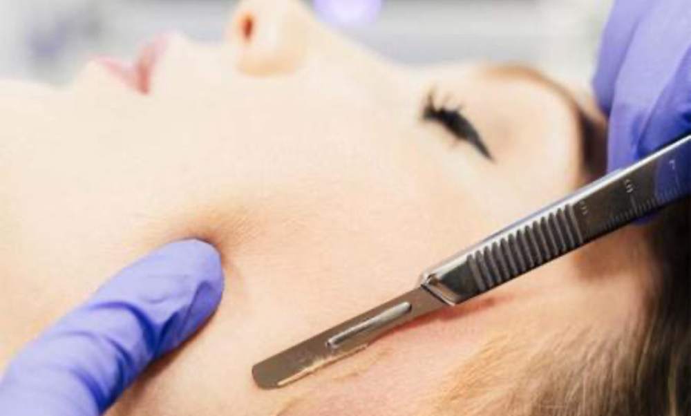 DERMAPLANE FACIAL