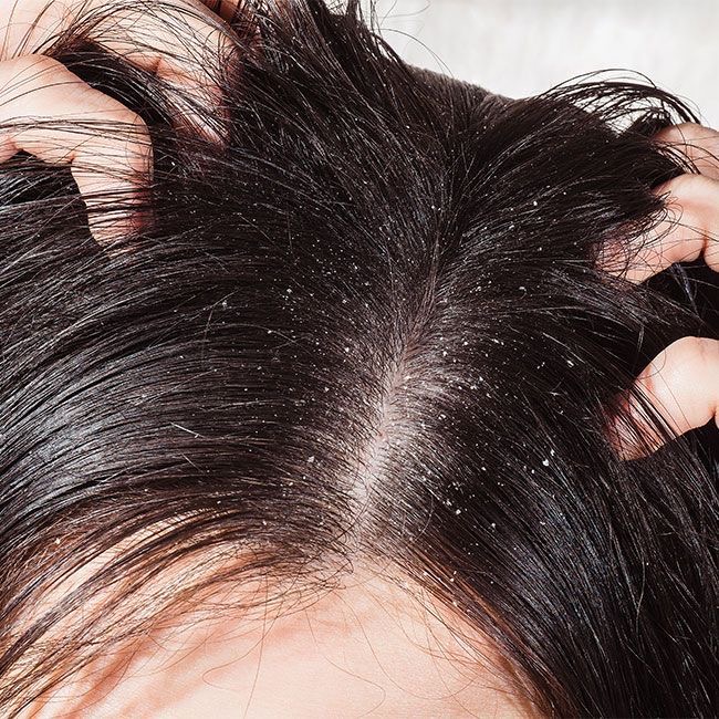 Scalp Detox/Treatment And Massage