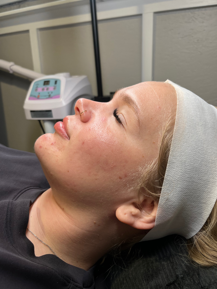 Express Dermaplane