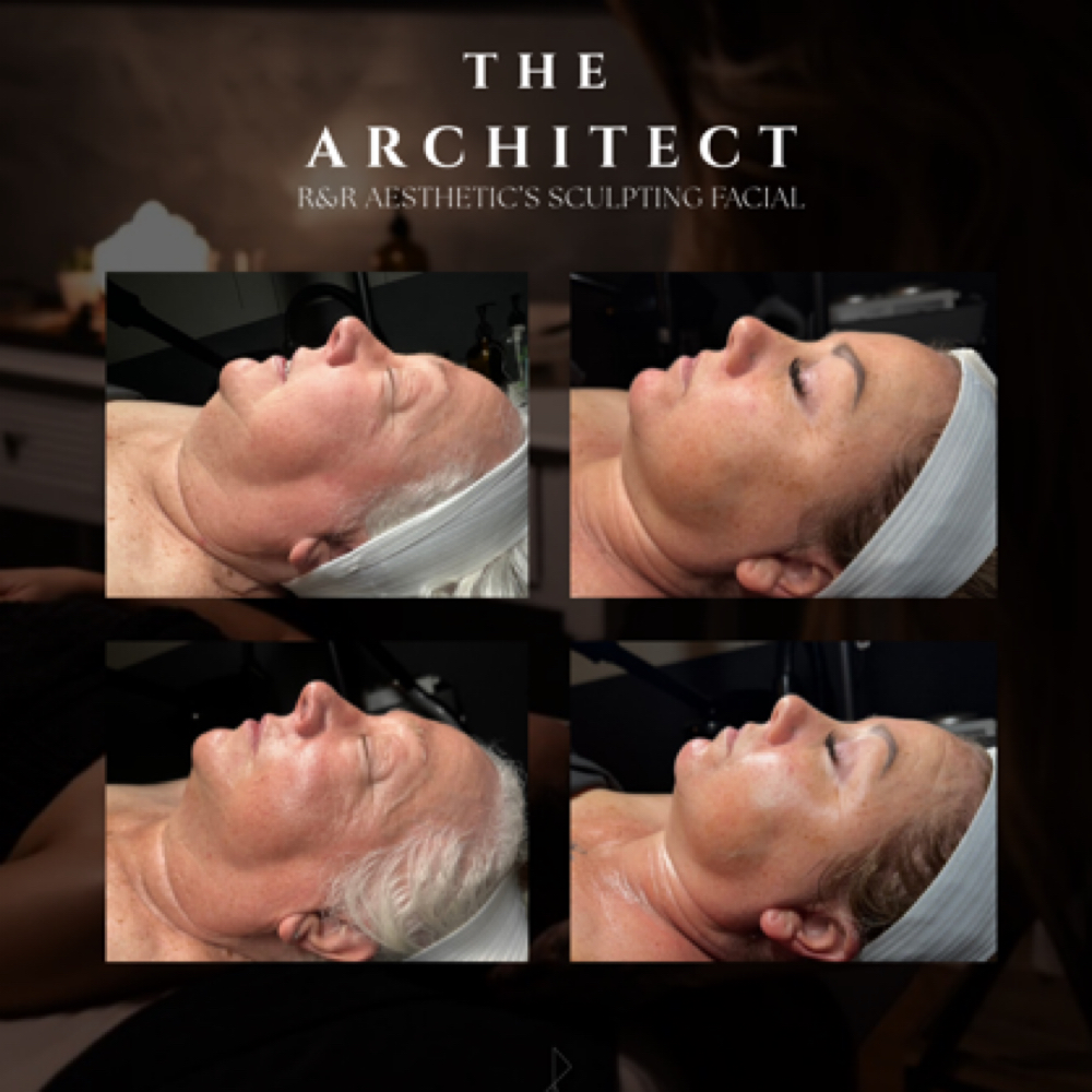 the ARCHITECT (Sculpting Facial)