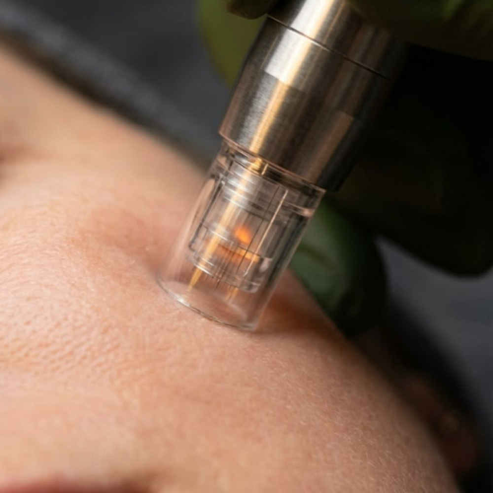 Nano Glow Facial at Zenith Esthetics in Lowell, AR