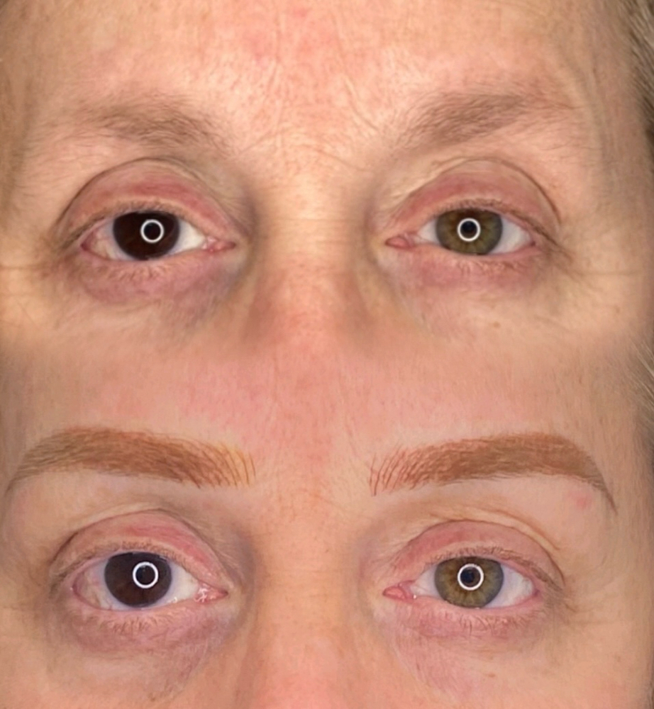 6-8 Week Touch Up