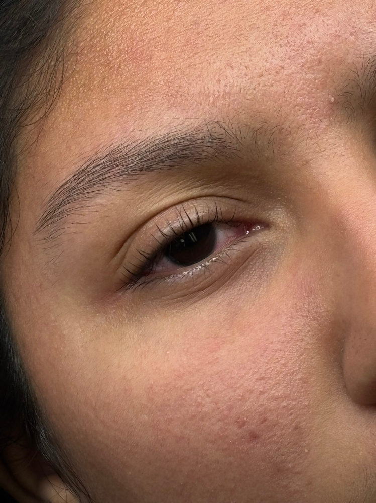 Lash Lift