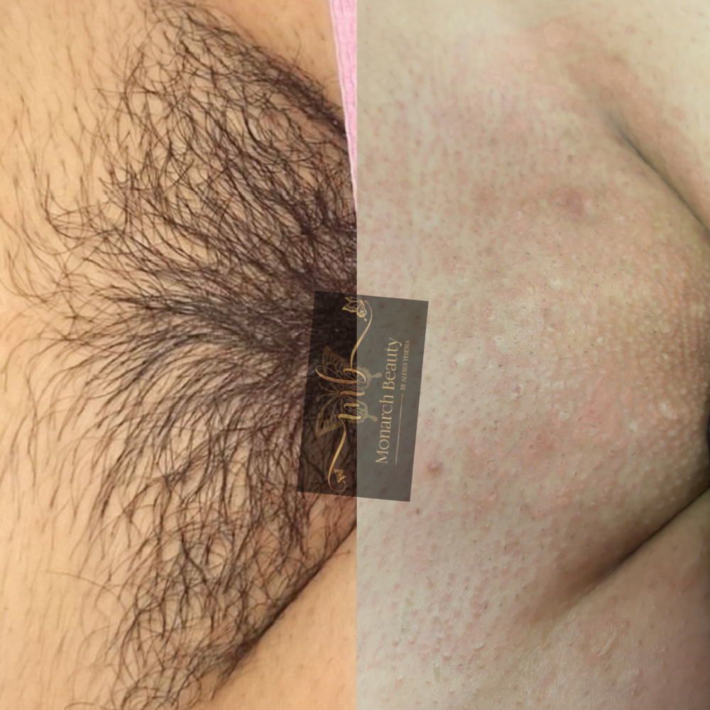 FULL BRAZILIAN WAX