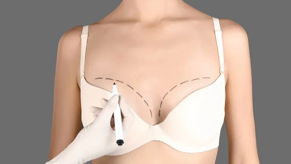 Non Invasive Breast Lift