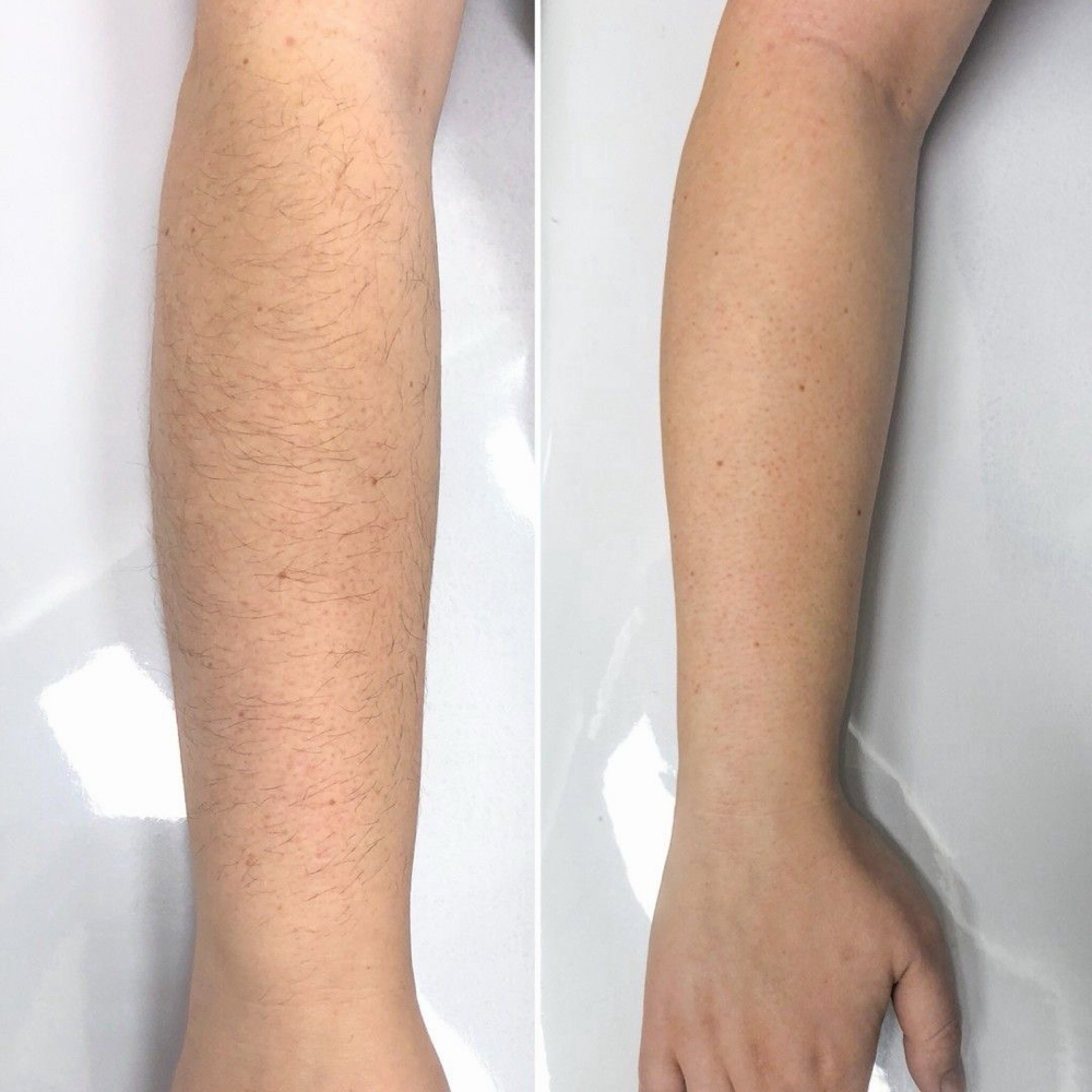 Half Arm Wax at Idaho Beauty Lounge in Eagle, ID