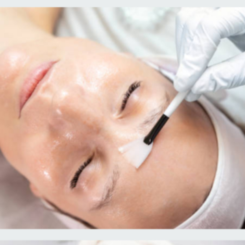 VI Chemical Peel at Stone Cosmetic Solutions in Ponca City, OK
