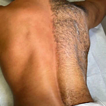 Full Back at Hidden Beauty Wax & Spa in Arlington, TX