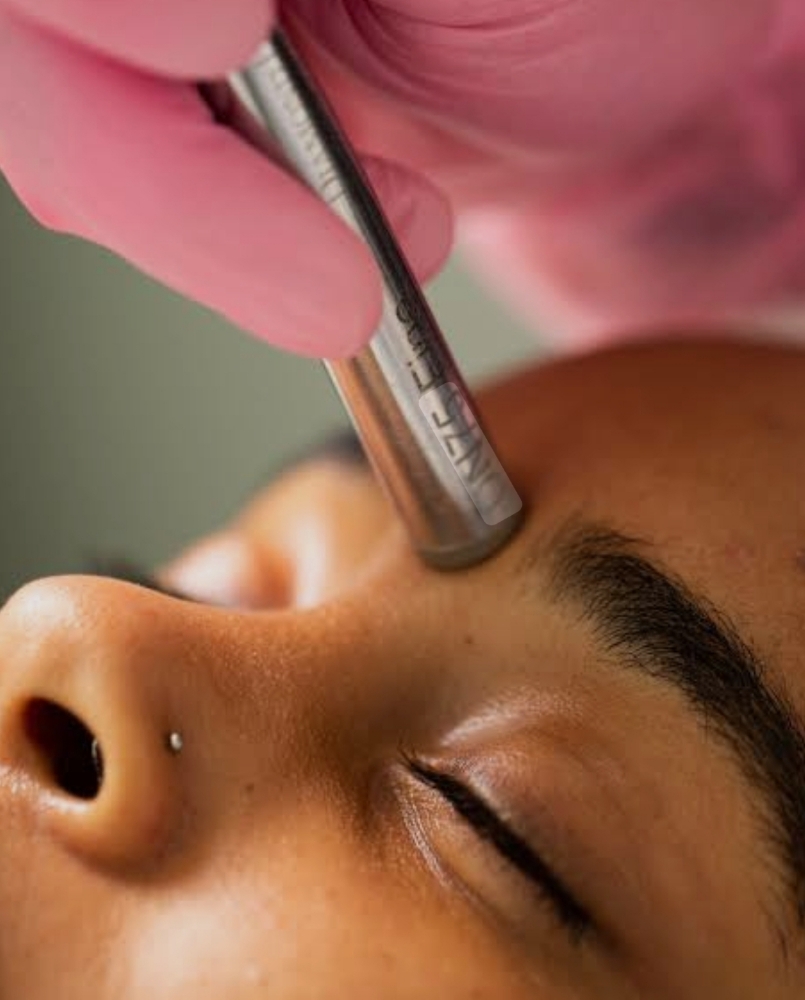 Microderm Facial