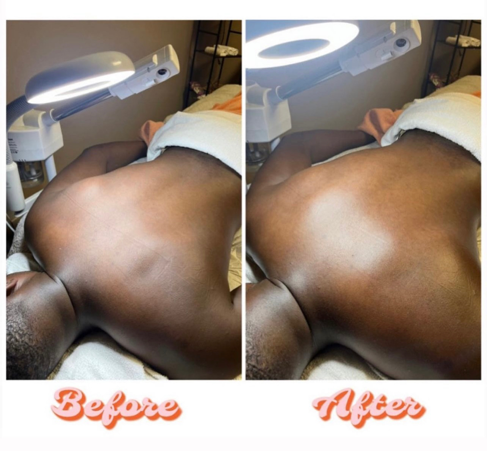 30 Min Bacial (Back Facial)