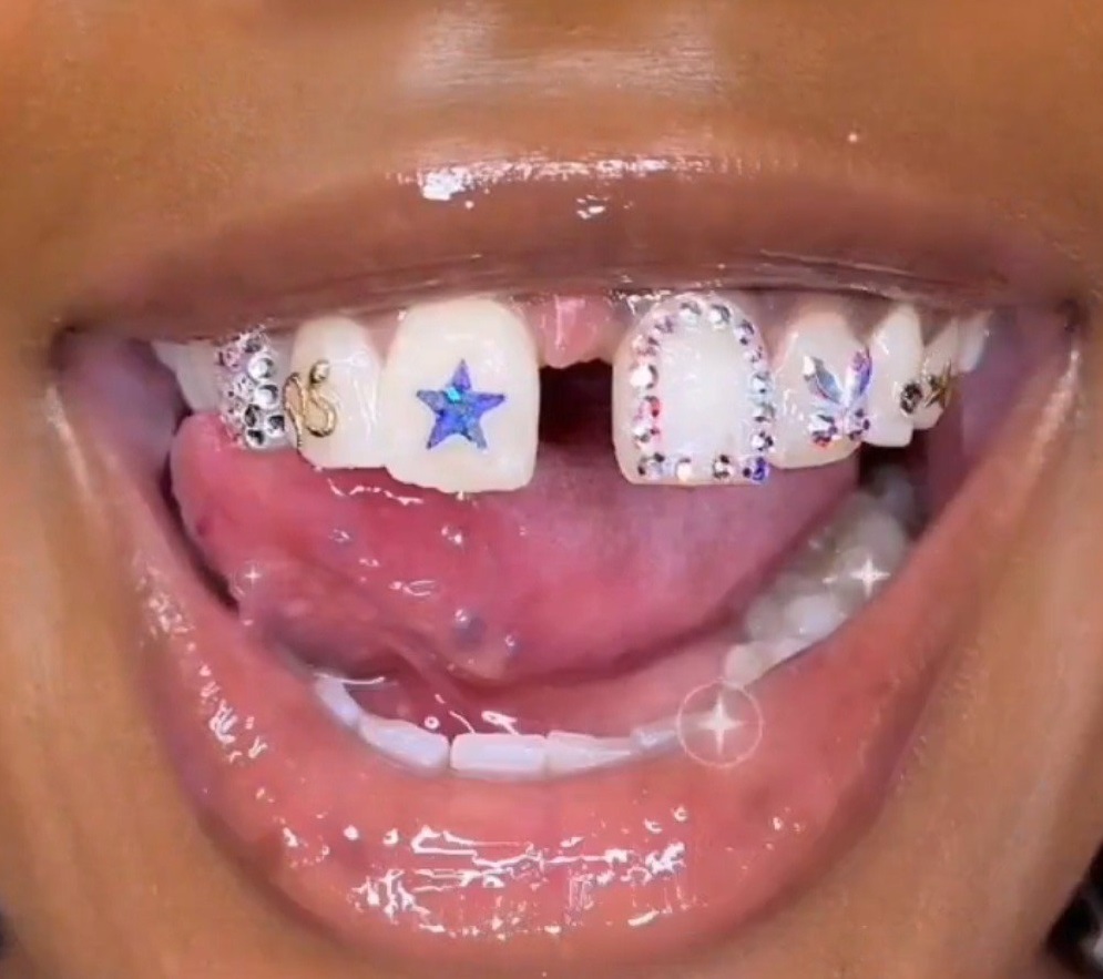 Tooth Gem Freestyle - 8 Teeth