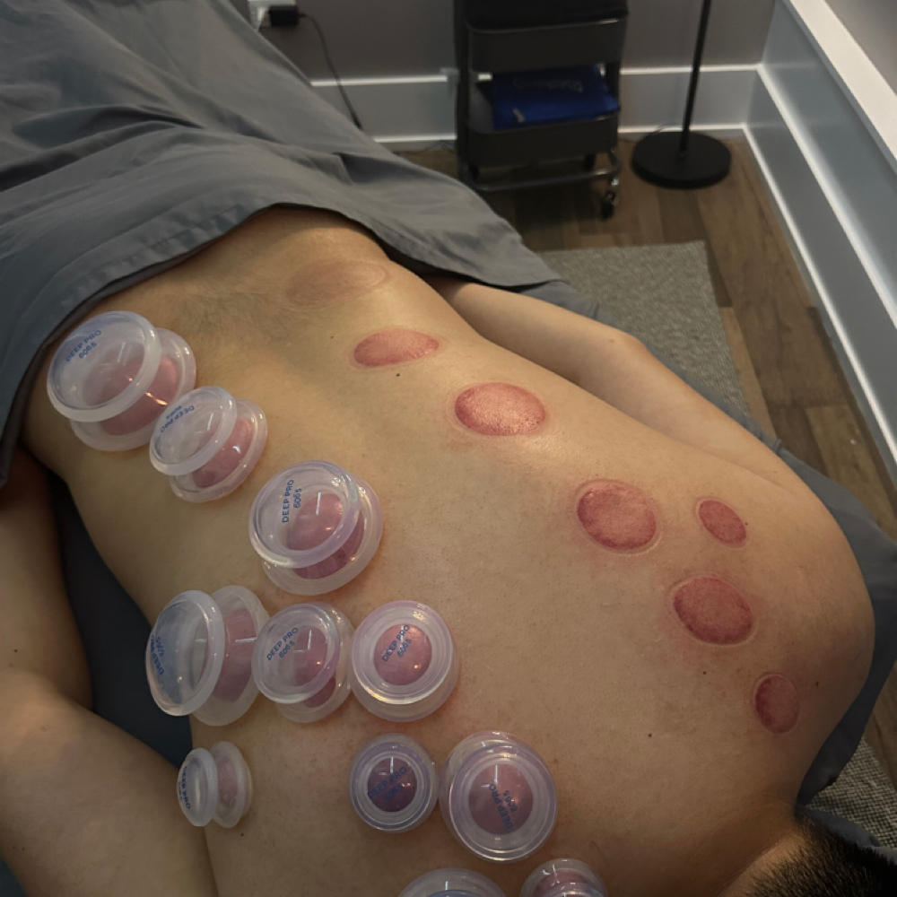 120 Min Custom Massage With Cupping at JJ Hands On Massage Therapy in Schaumburg, IL
