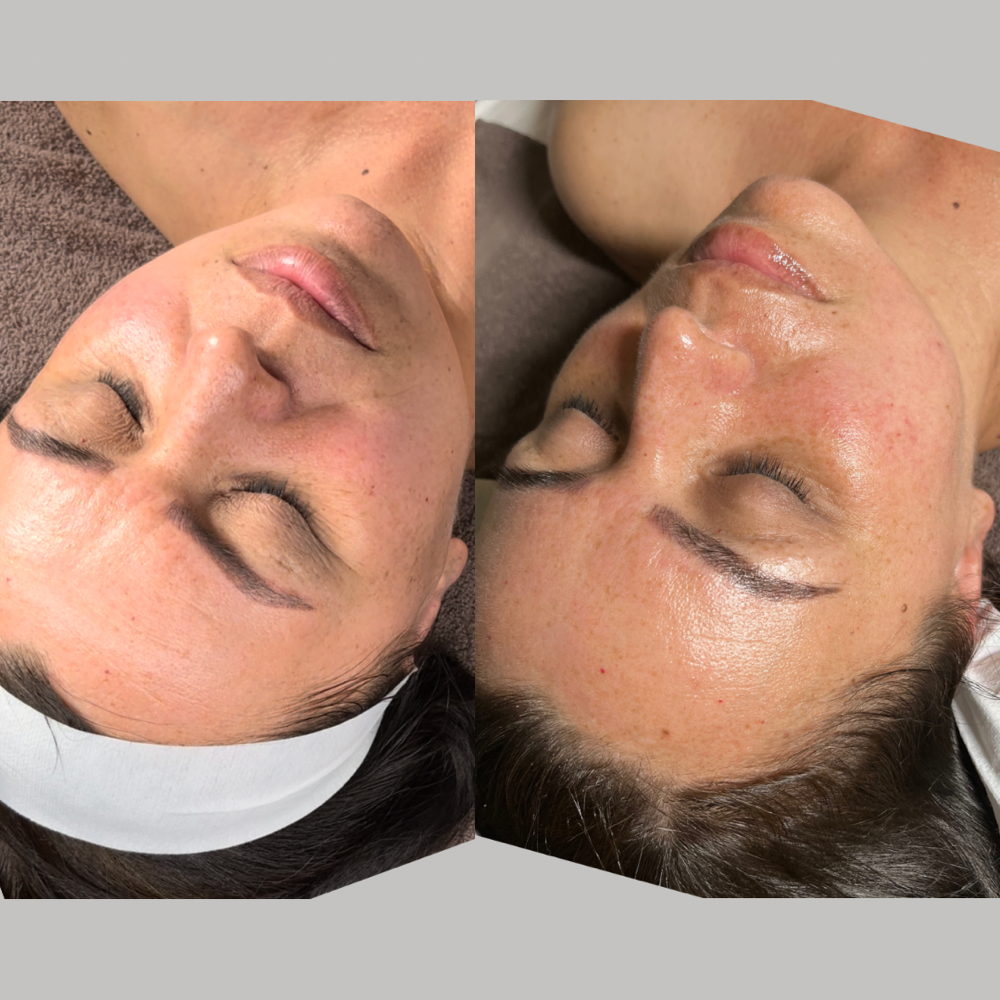 Sculpt & Glow Facial