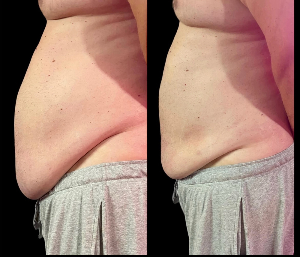 MEN(tighten&tone)Stomach,Pecs,Sides
