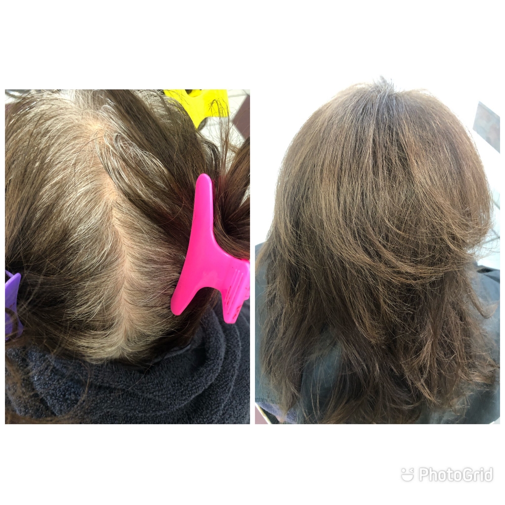 Root Touch-Up
