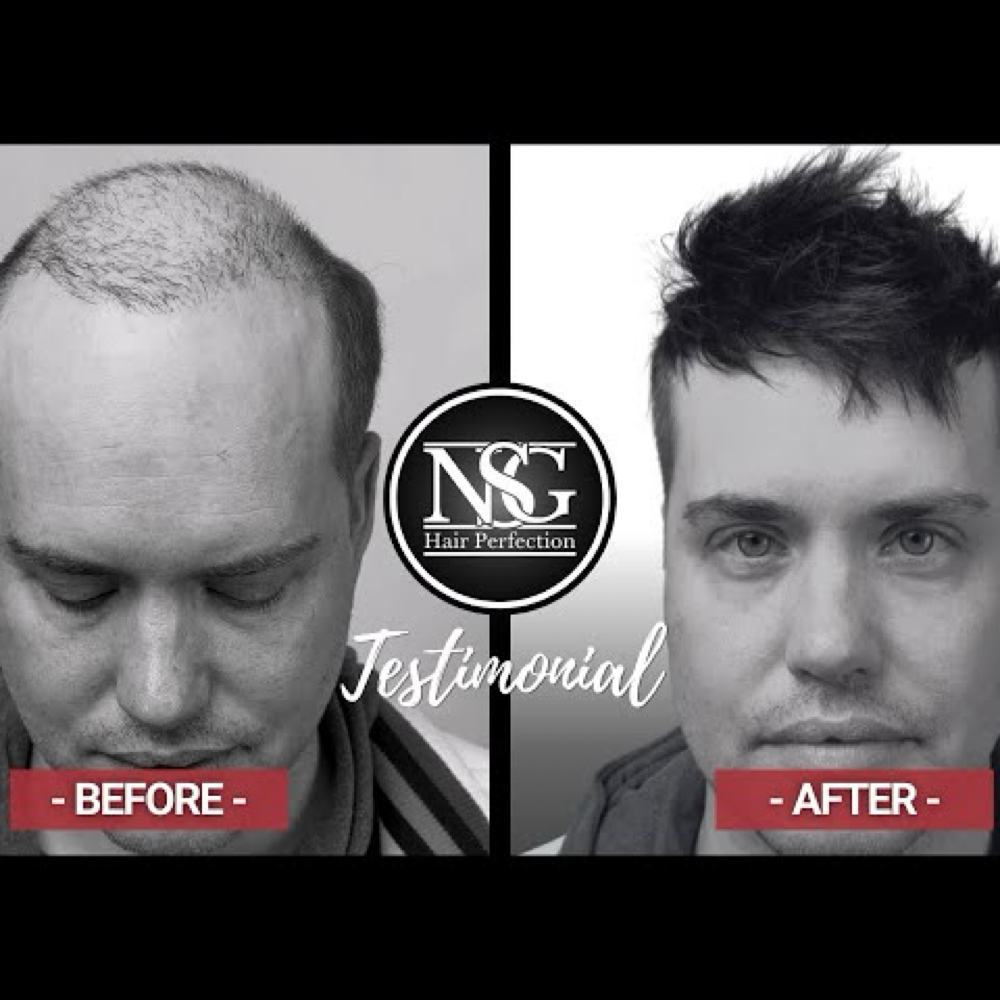 NSG Hair Replacement at Custom Hair By Charity in Spokane, WA