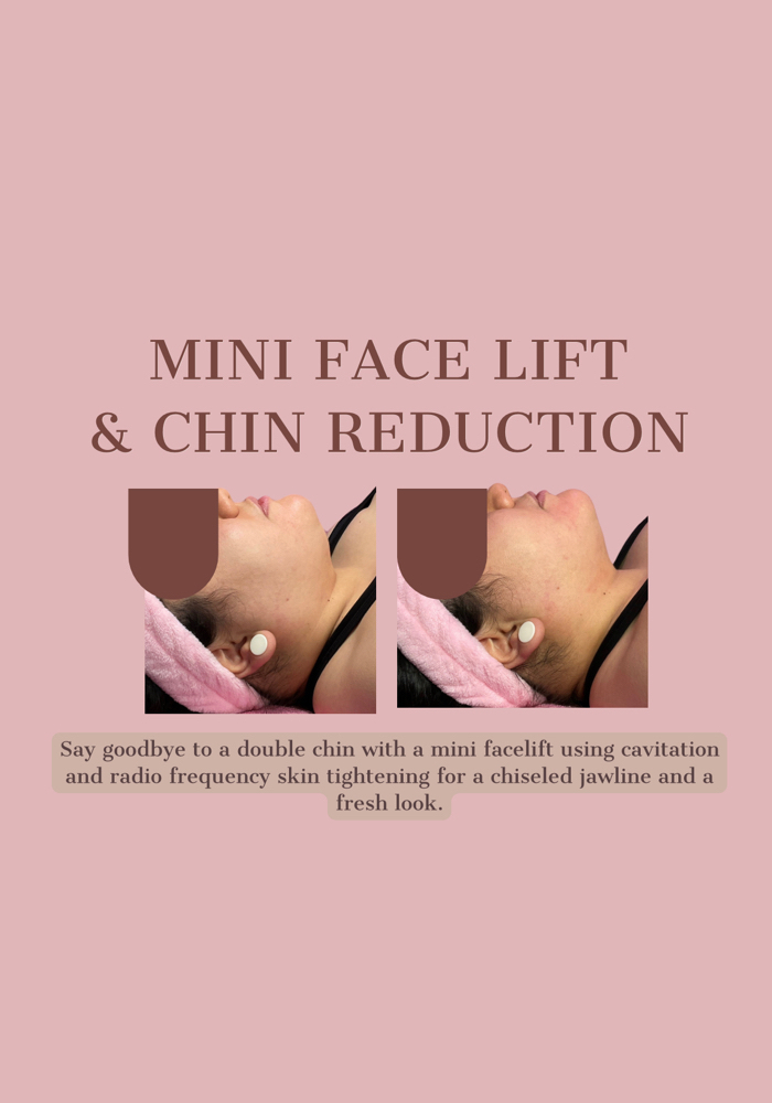 Chin & Face Lift