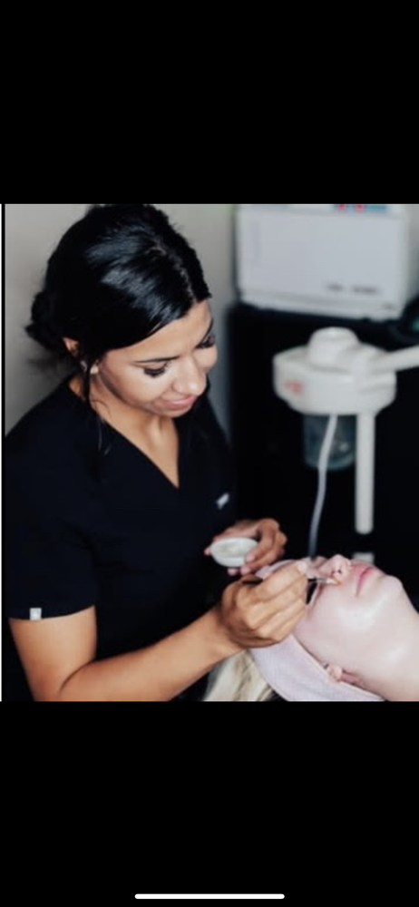 CANDOUR Advanced Renewal Peel at Candour Skin Studio in Yuma, AZ