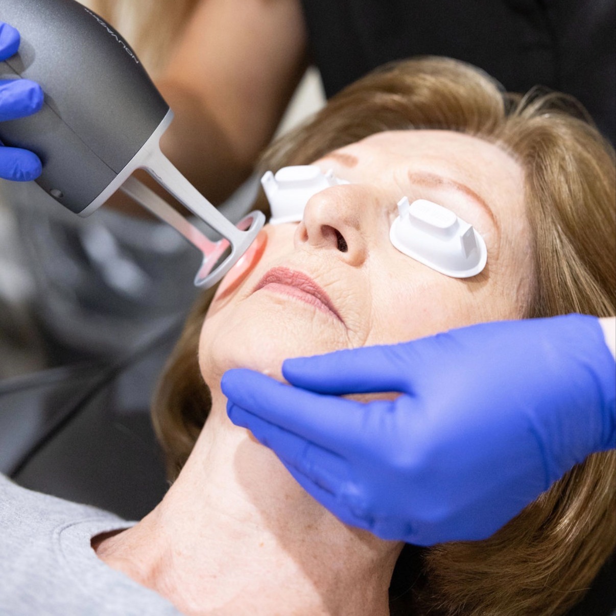 NouvaDerm Classic at Revitalize Health in Florence, SC